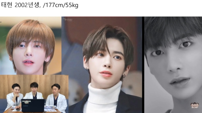 TOMORROW X TOGETHER(TXT)テヒョン整形