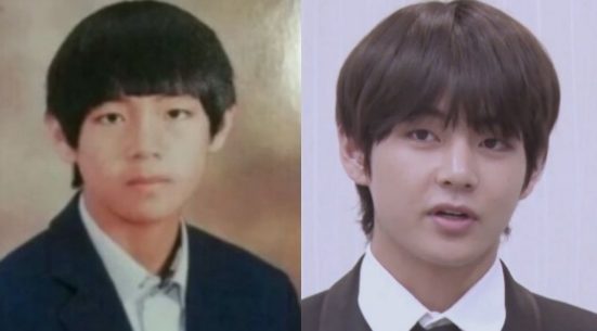 BTSメンバーの顔の変遷と整形疑惑