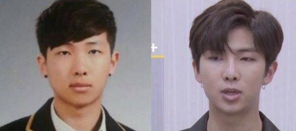 BTSメンバーの顔の変遷と整形疑惑